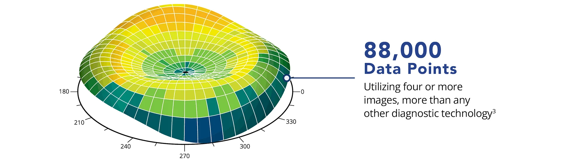 Alcon chart: Contoura Vision uses up to 88,000 corneal data points from four or more topography images
